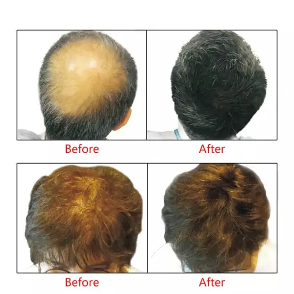 DeXe Hair Building Fibers - 22G